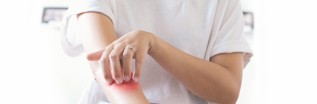 Psoriasis, estrés y confinamiento por COVID-19