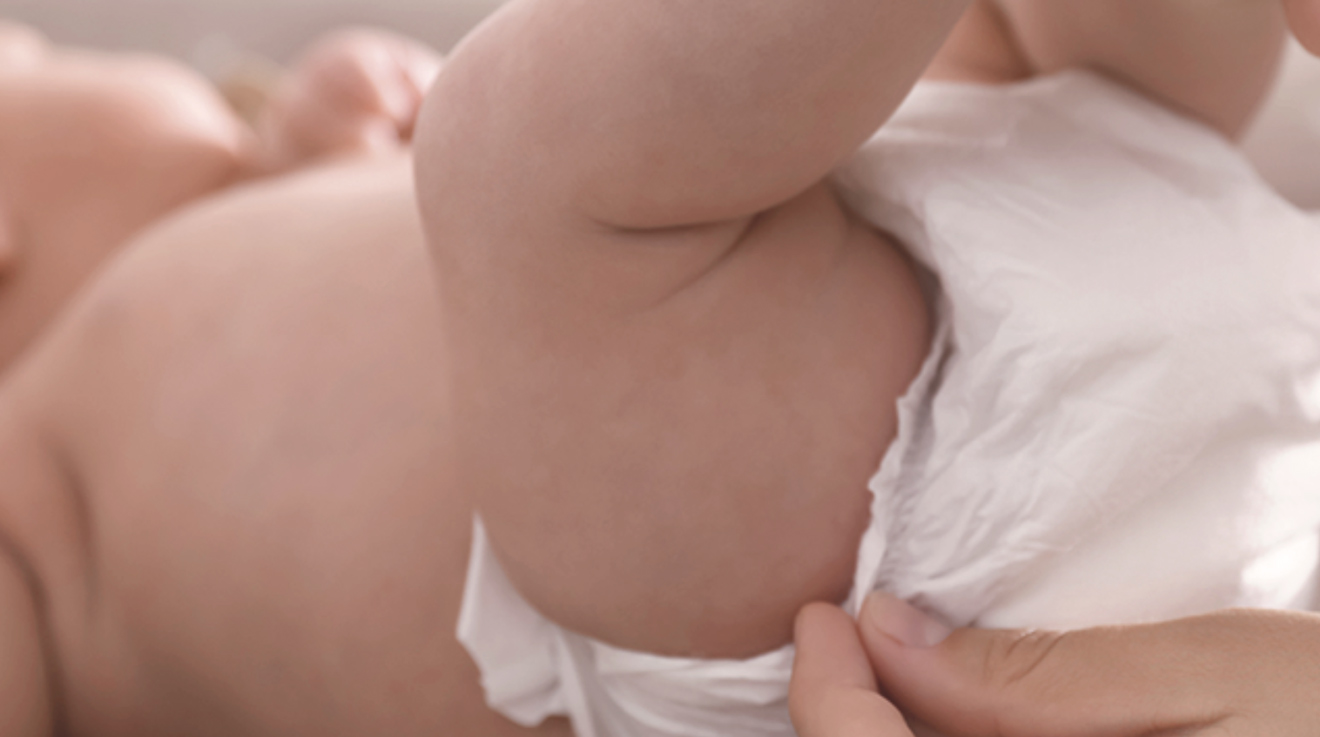 ¿Es bueno hacer la circuncisión a los bebés recién nacidos?