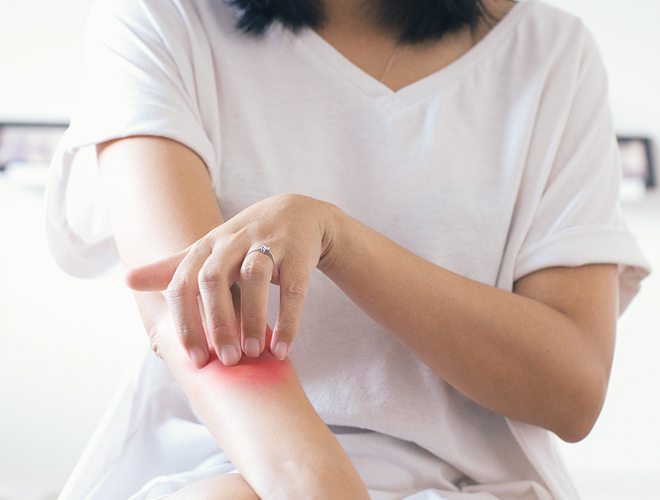 Psoriasis, estrés y confinamiento por COVID-19