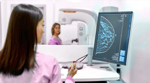 Detecta a tiempo el cáncer de mama
