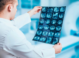 Recomendaciones para pacientes oncológicos