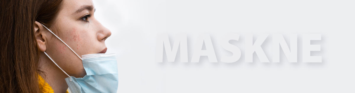 COVID-19: CóMO LIDIAR CON EL “MASKNE” (ACNé PRODUCIDO POR LA MASCARILLA)