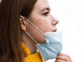 COVID-19: CóMO LIDIAR CON EL “MASKNE” (ACNé PRODUCIDO POR LA MASCARILLA)
