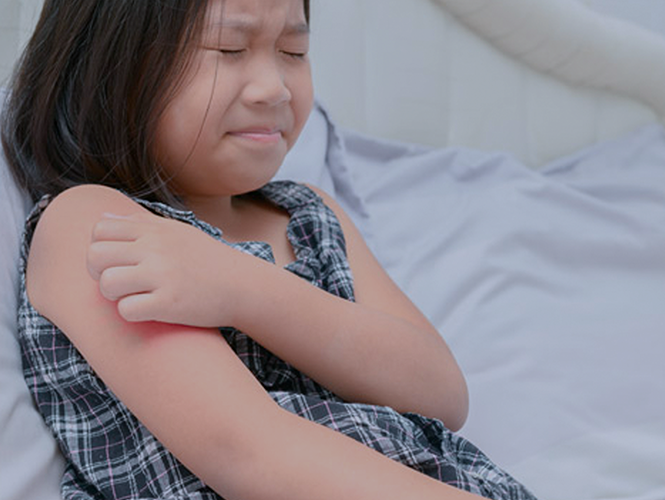 ¿Cómo se realiza un diagnóstico de Alergia en niños?
