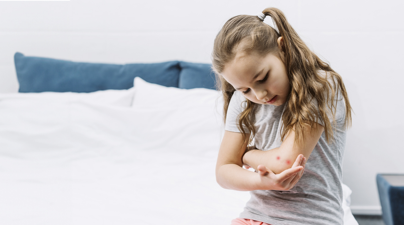 Picaduras de insectos en niños: ¿cómo actuar ante reacciones alérgicas?