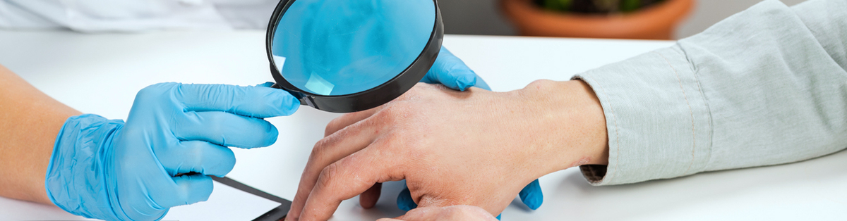 Genodermatosis, ¿qué es?