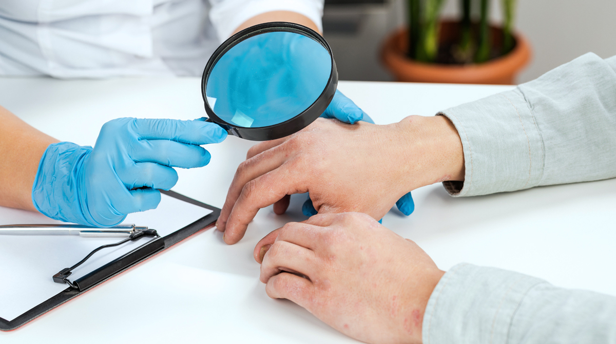 Genodermatosis, ¿qué es?