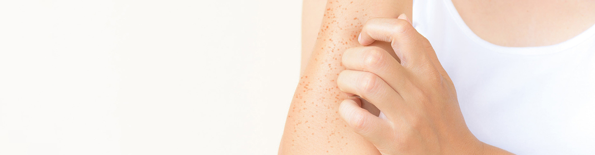 Queratosis Pilaris: Pequeños granos la piel, ¿a qué se debe?